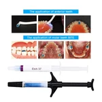 Dental Light Cure Orthodontic Adhesive Kit Fit Open Bite And Ortho Band Bonding. Fixed Price $20.23.